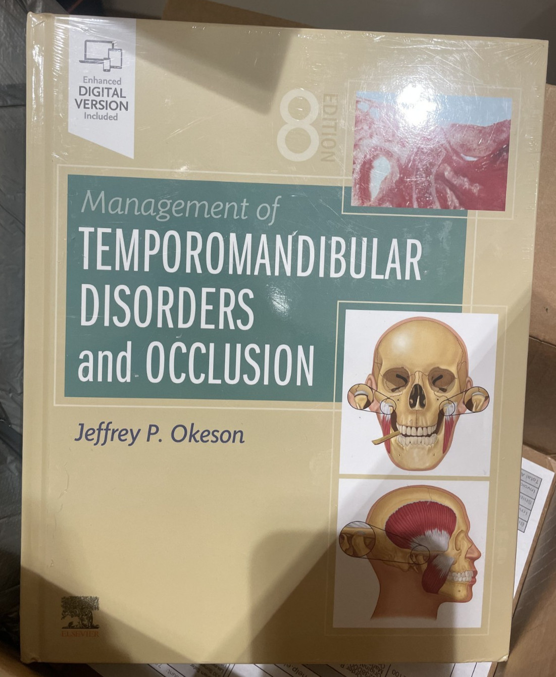 Management of Temporomandibular Disorders and Occlusion by Okeson DMD