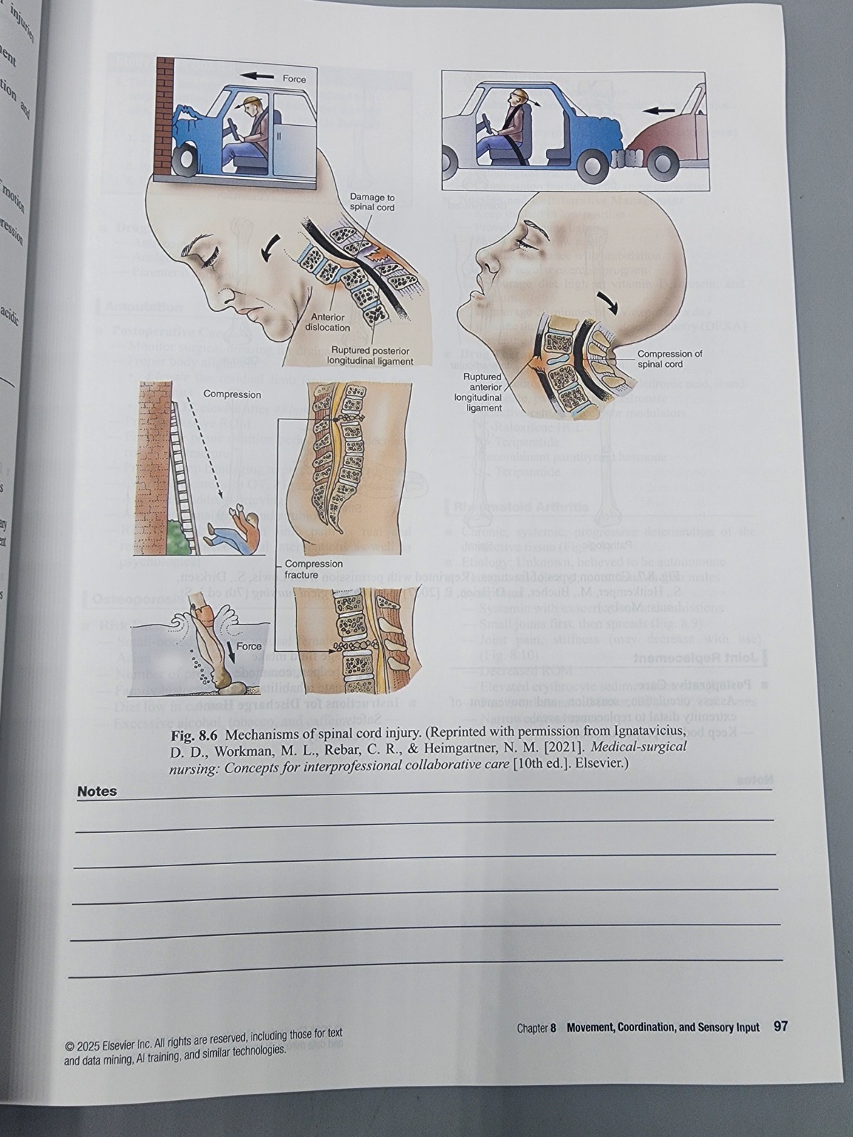 HESI Live Review Wkbk for the NCLEX-RN Examination 9th Ed 2025