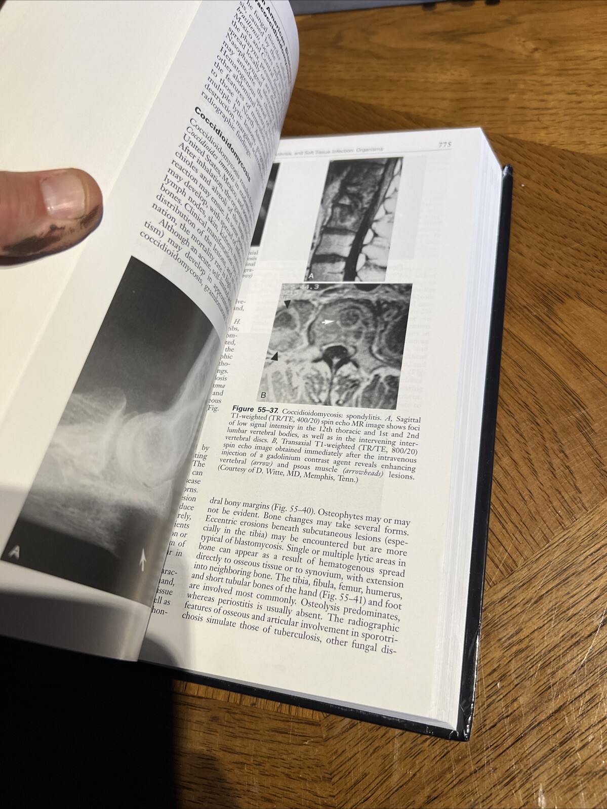 Bone and Joint Imaging Hardcover Mark J., Resnick, Donald L. Kran