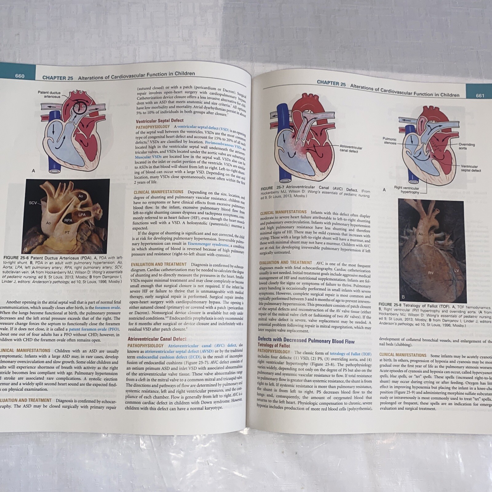 Understanding Pathophysiology by Kathryn L. McCance and Sue E. Huether (2016,…