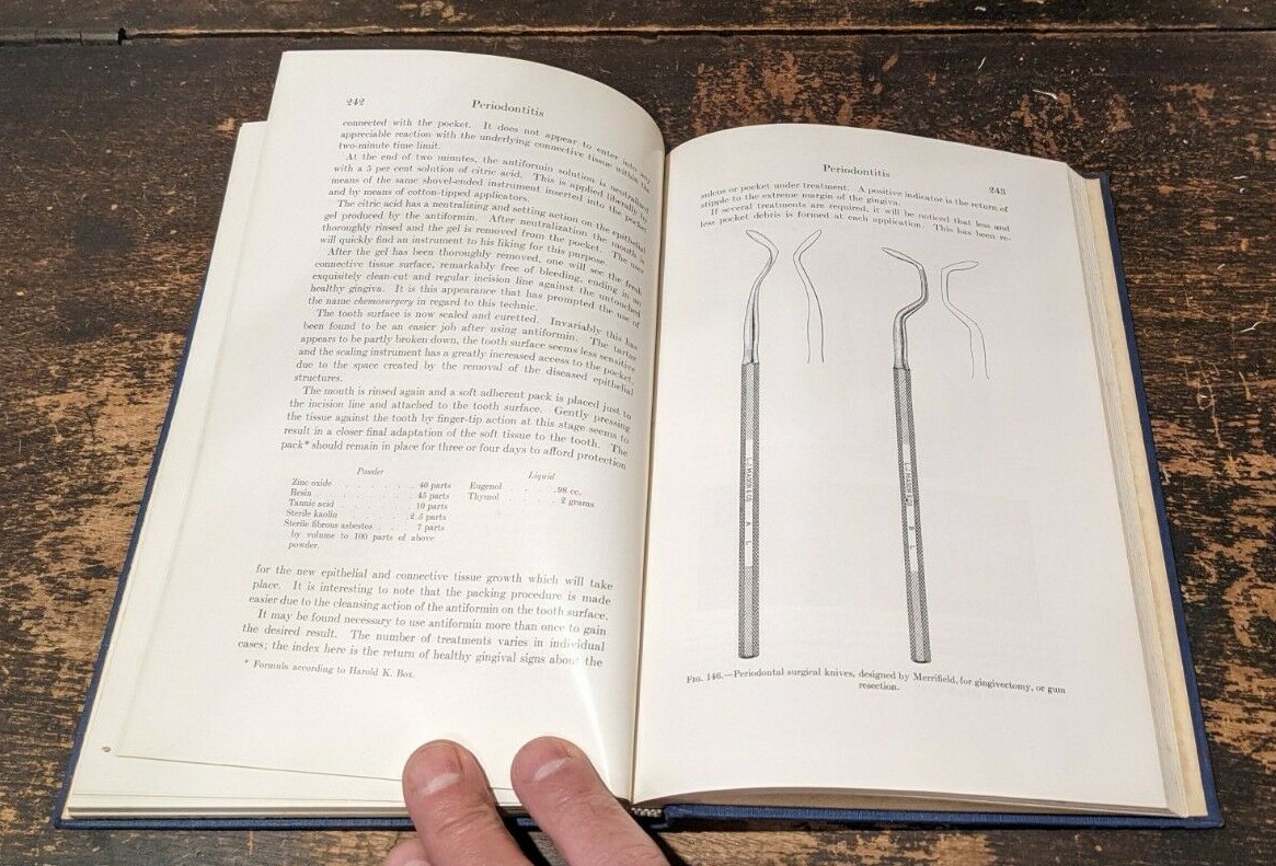 Periodontia, by Edgar D. Coolidge, Maynard K. Hine, Lea & Febiger, 1954-384pages