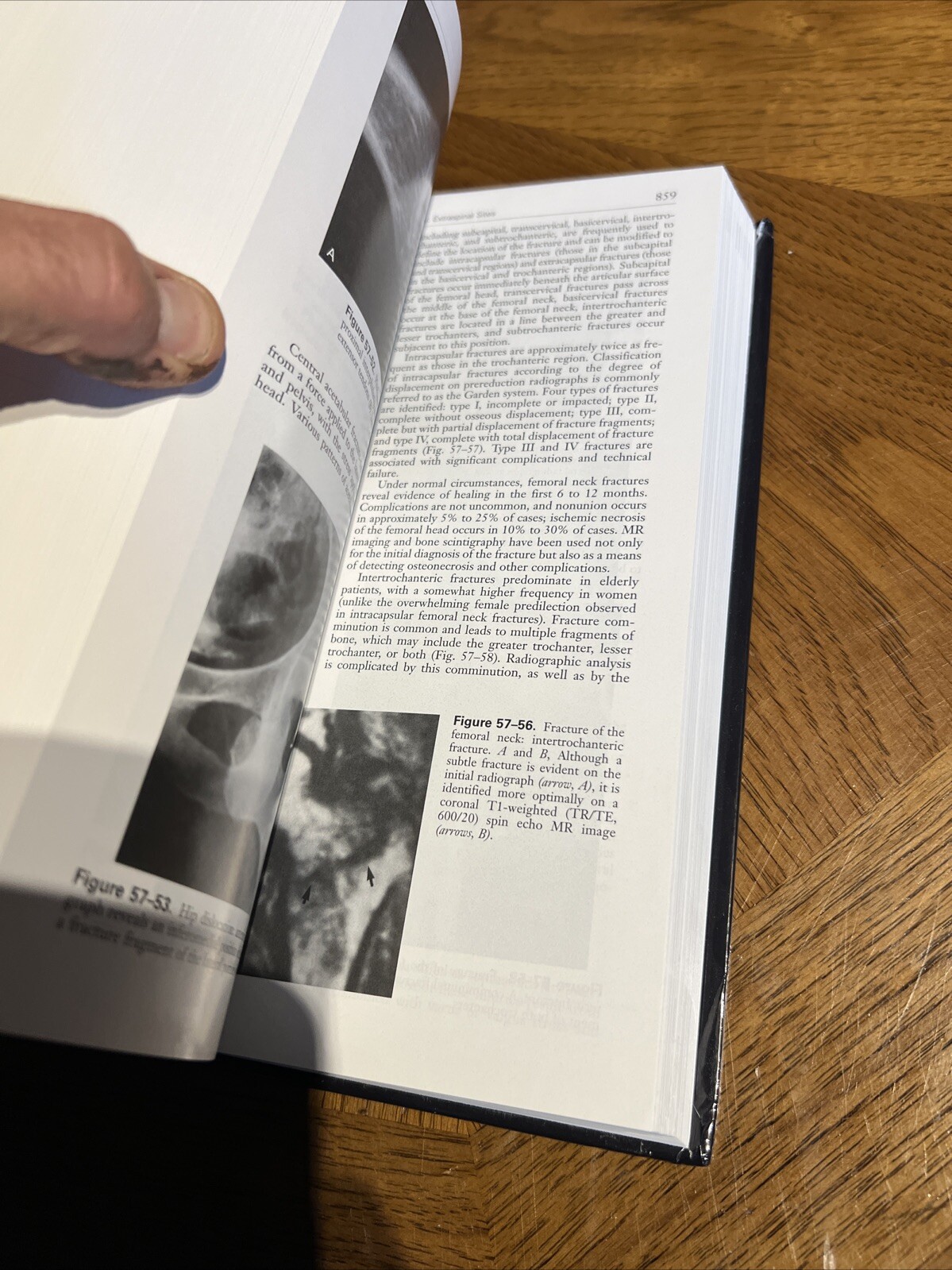 Bone and Joint Imaging Hardcover Mark J., Resnick, Donald L. Kran