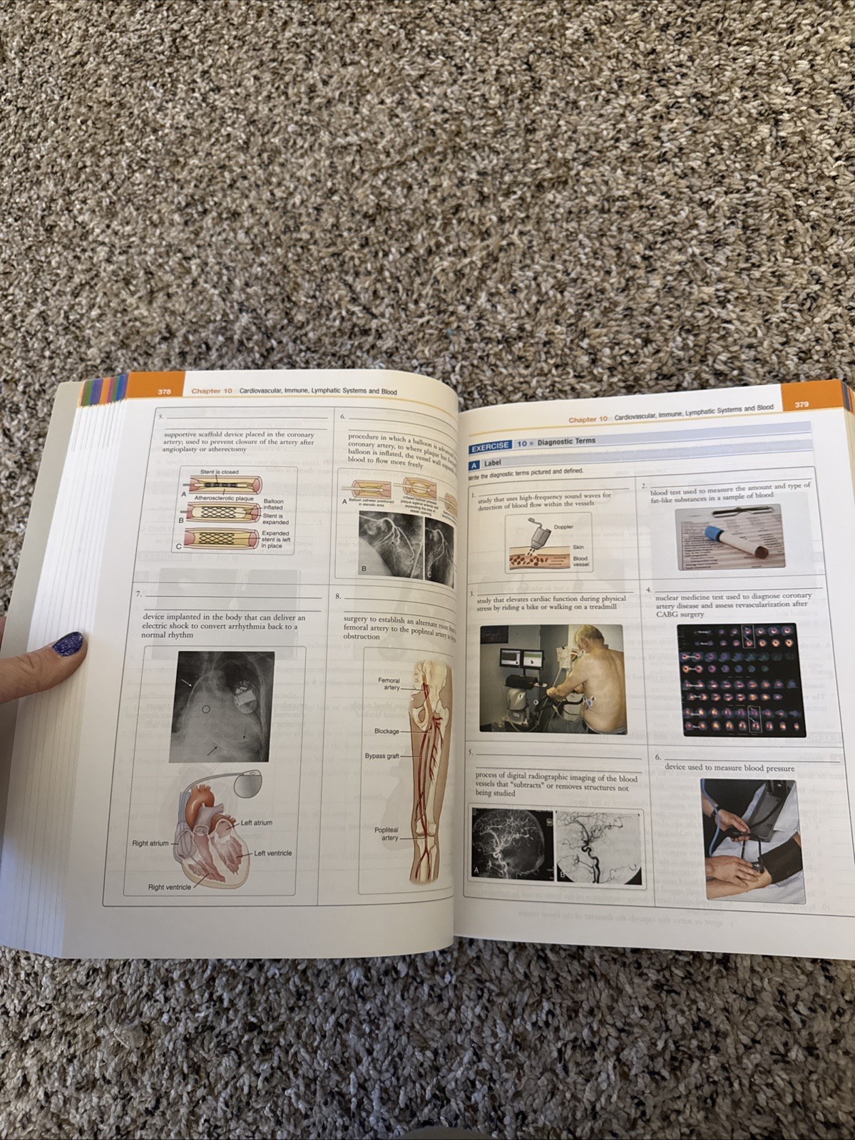 Exploring Medical Language : A Student-Directed Approach by Danielle LaFleur…