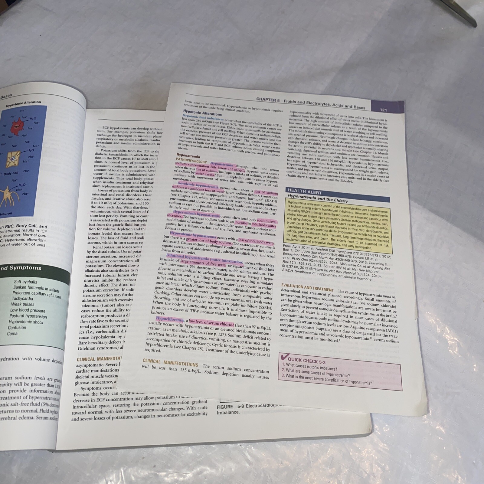Understanding Pathophysiology by Kathryn L. McCance and Sue E. Huether (2016,…