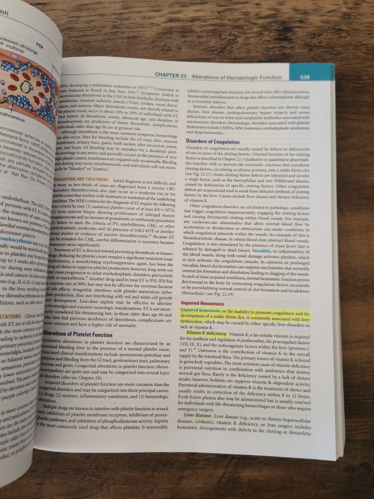 Understanding Pathophysiology – Paperback By McCance RN PhD, Kathryn L. – GOOD
