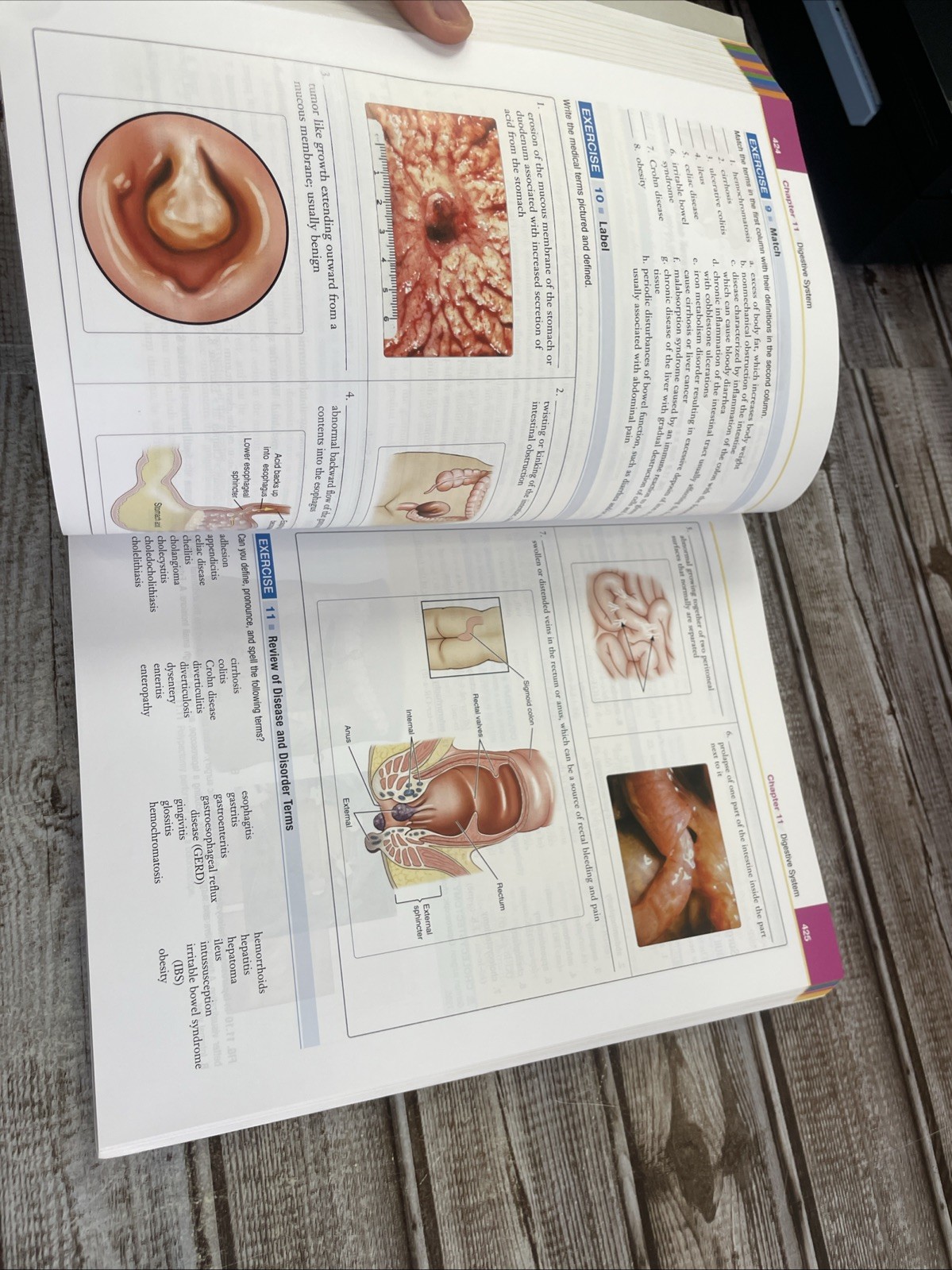 Exploring Medical Language 11th Ed Brooks Paperback Elsevier Access Code