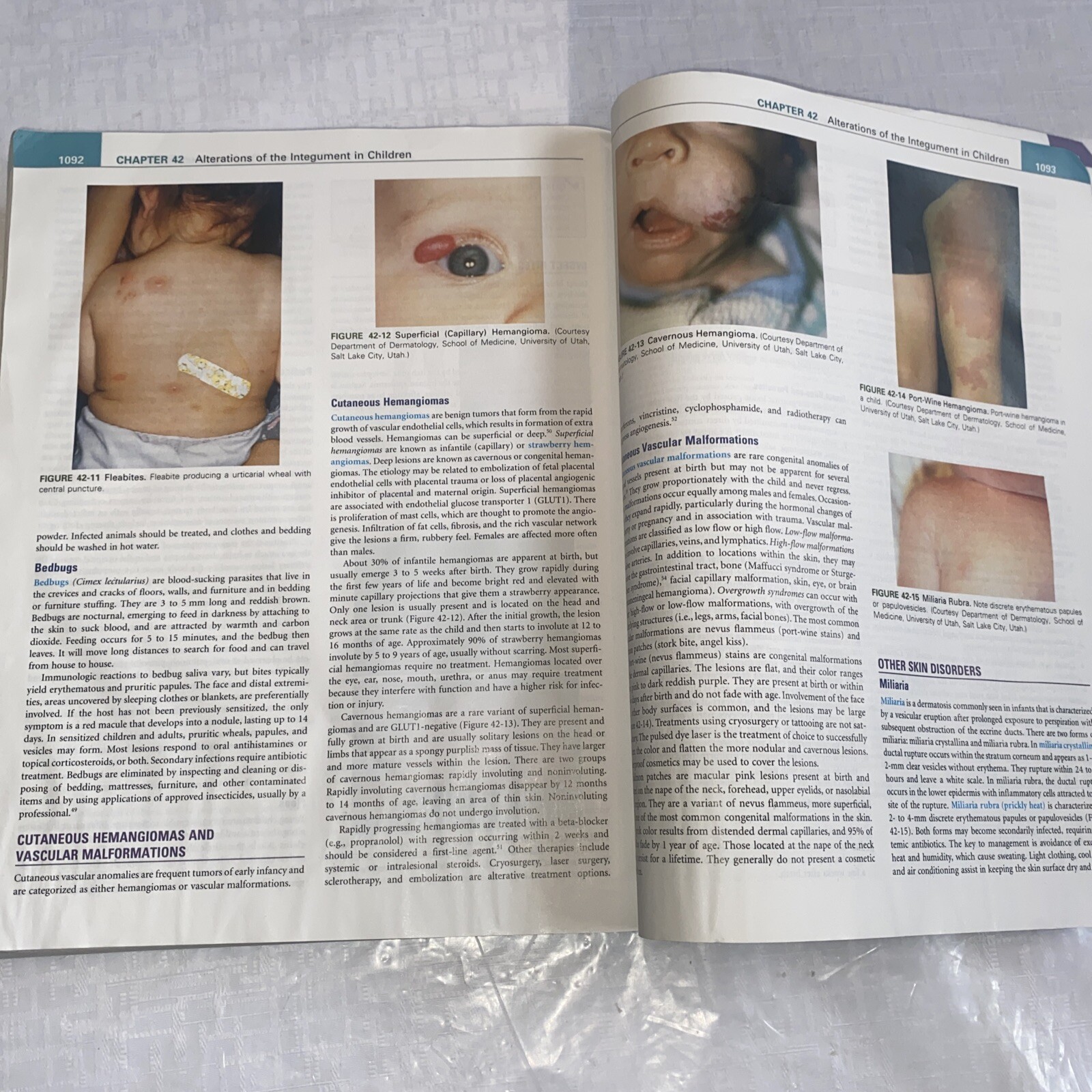 Understanding Pathophysiology by Kathryn L. McCance and Sue E. Huether (2016,…