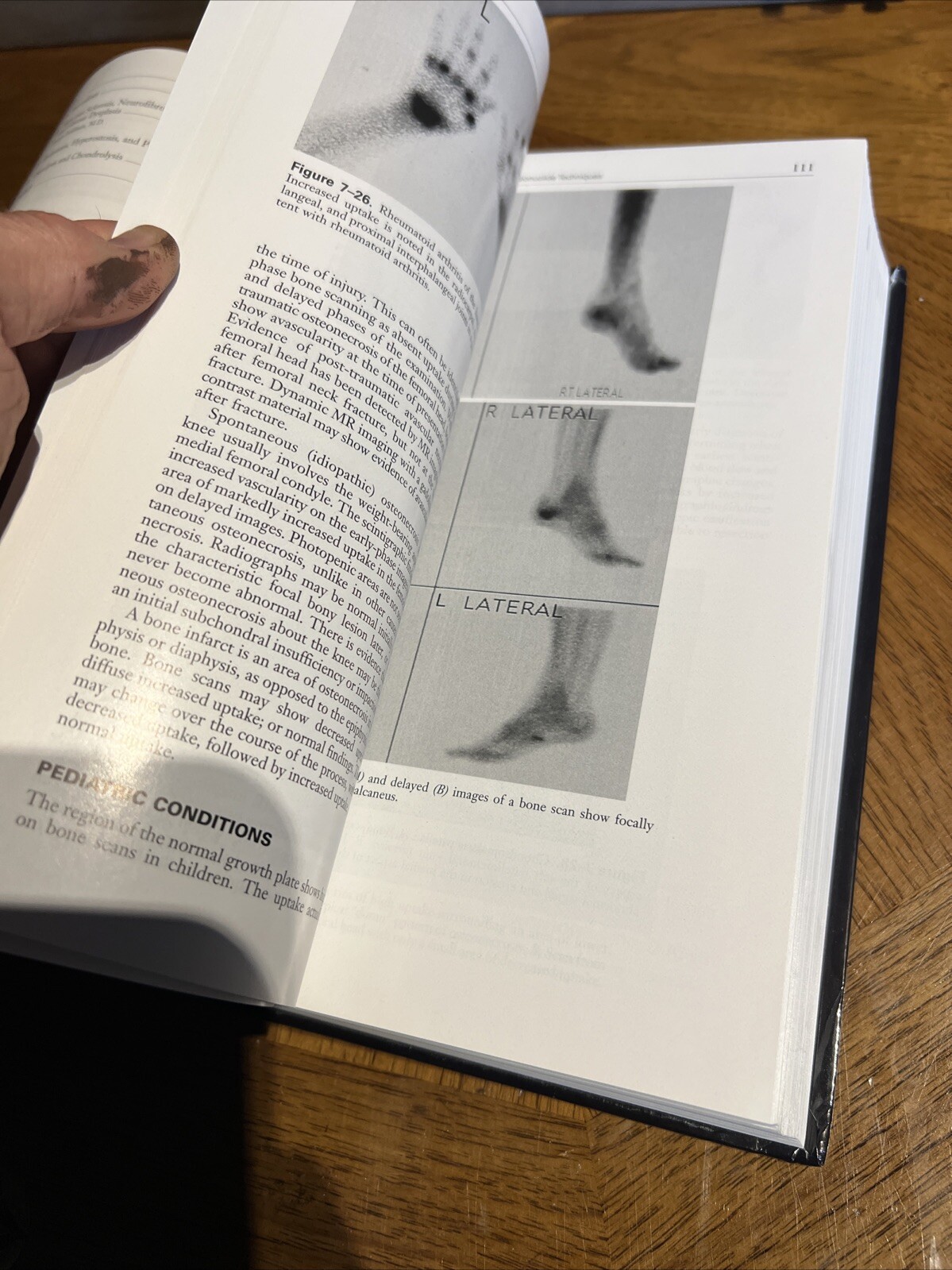 Bone and Joint Imaging Hardcover Mark J., Resnick, Donald L. Kran