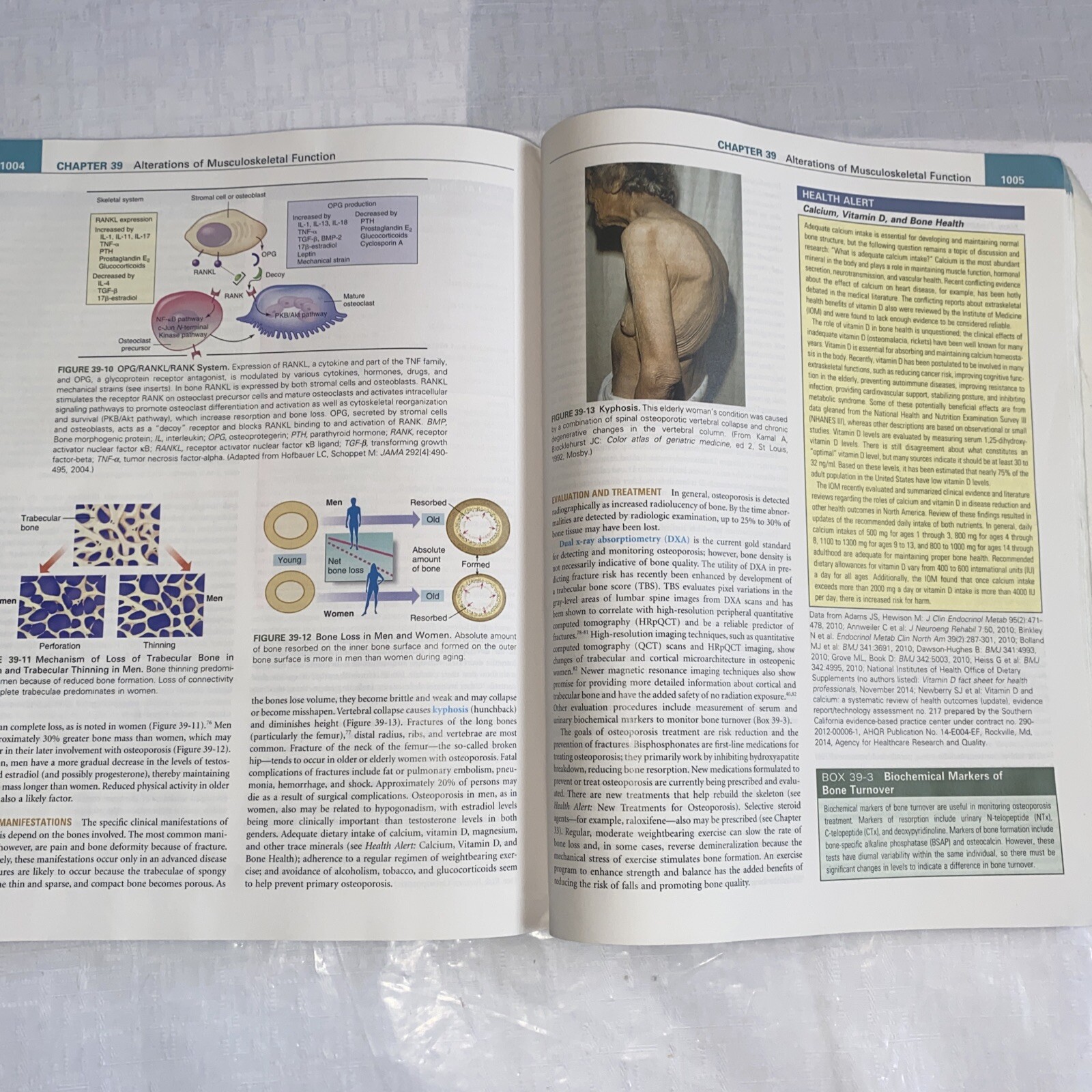 Understanding Pathophysiology by Kathryn L. McCance and Sue E. Huether (2016,…
