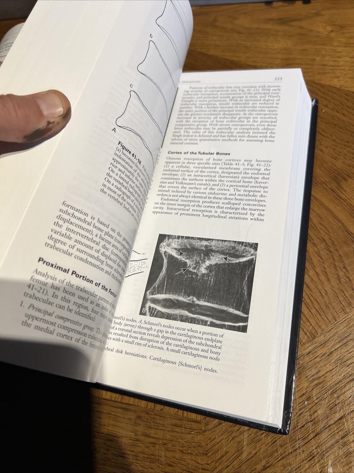 Bone and Joint Imaging Hardcover Mark J., Resnick, Donald L. Kran
