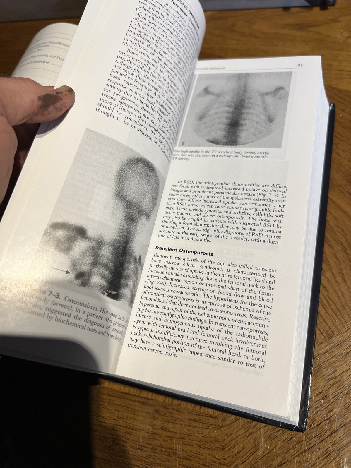Bone and Joint Imaging Hardcover Mark J., Resnick, Donald L. Kran